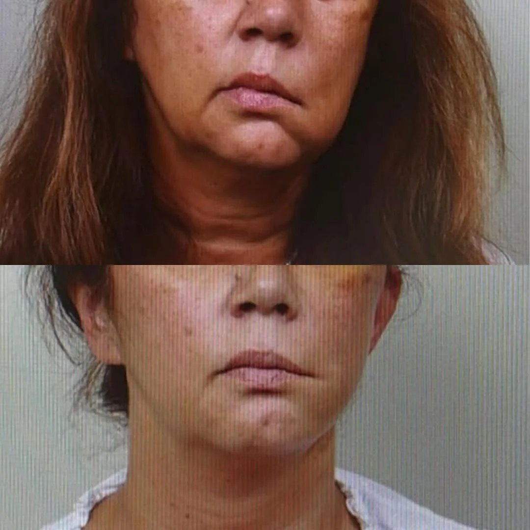 Before and after — Dr. David Neagu
