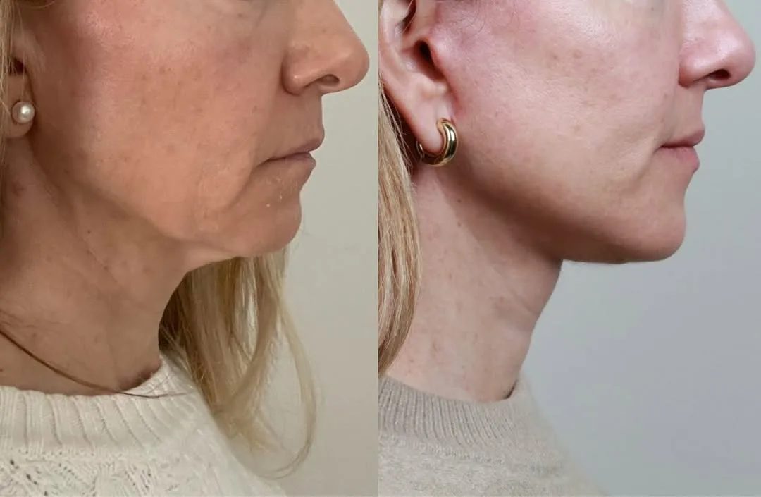 Before and after — Dr. David Neagu
