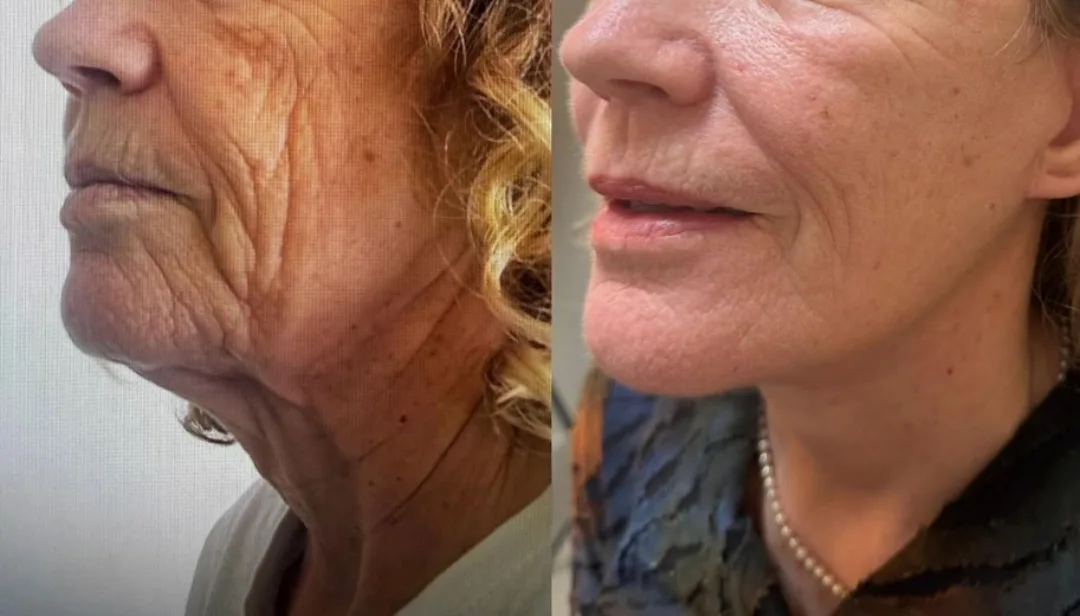 Before and after — Dr. David Neagu