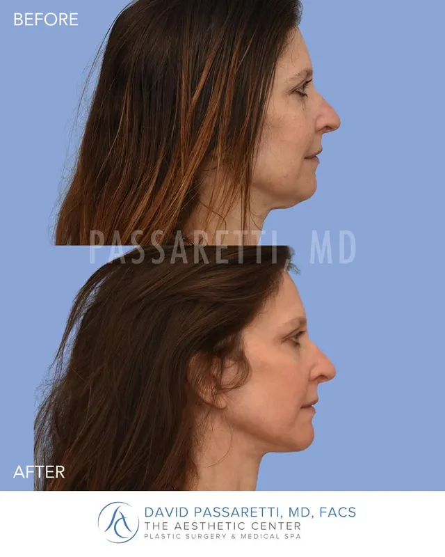 Before and after — Dr. David Passaretti