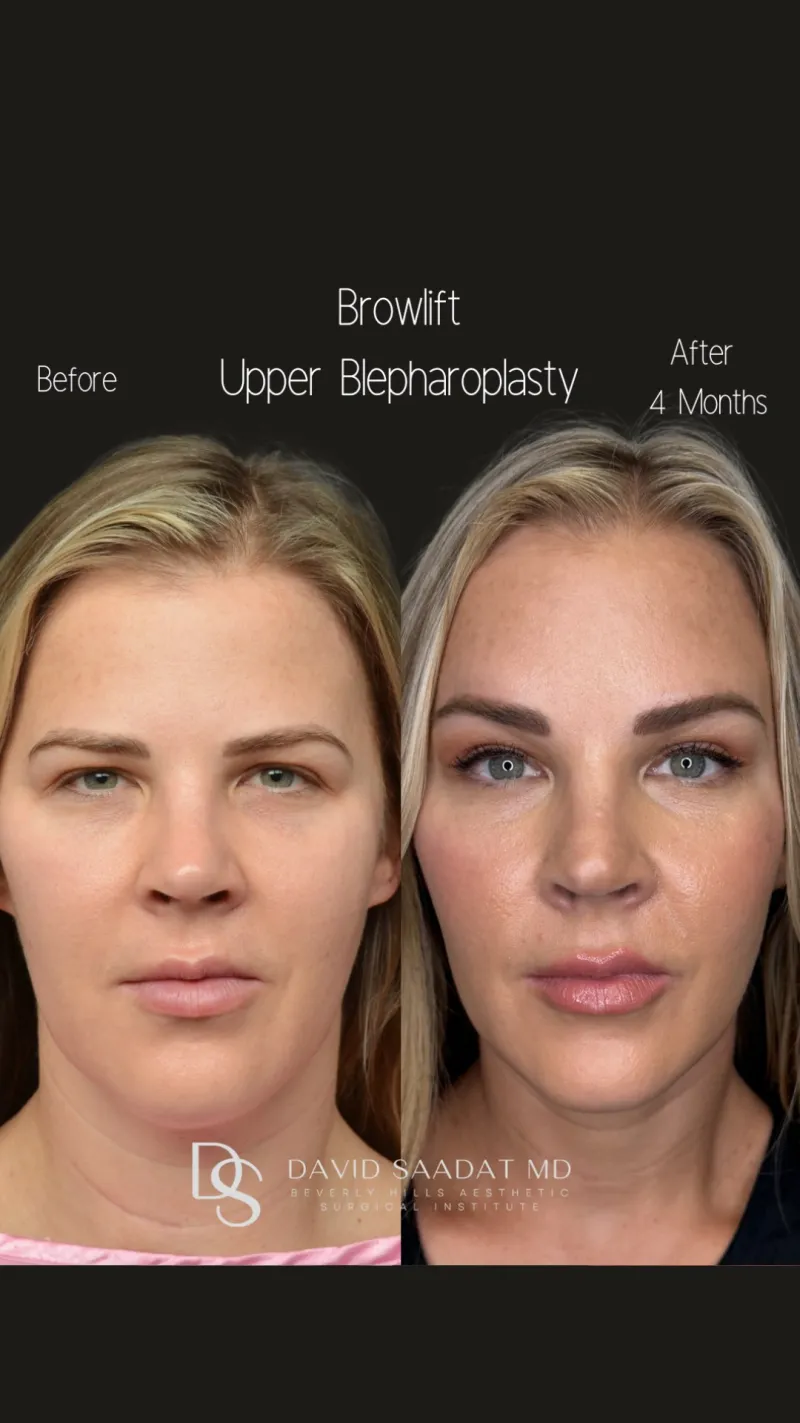 Before and after: Dr. David Saadat