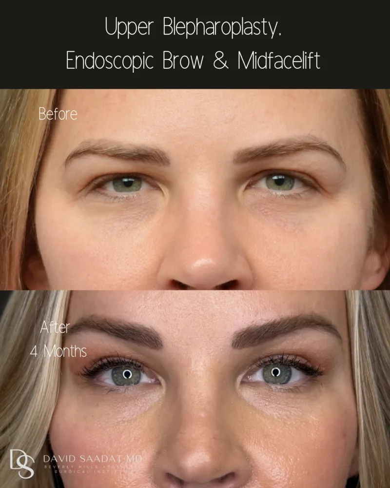 Before and after: Dr. David Saadat