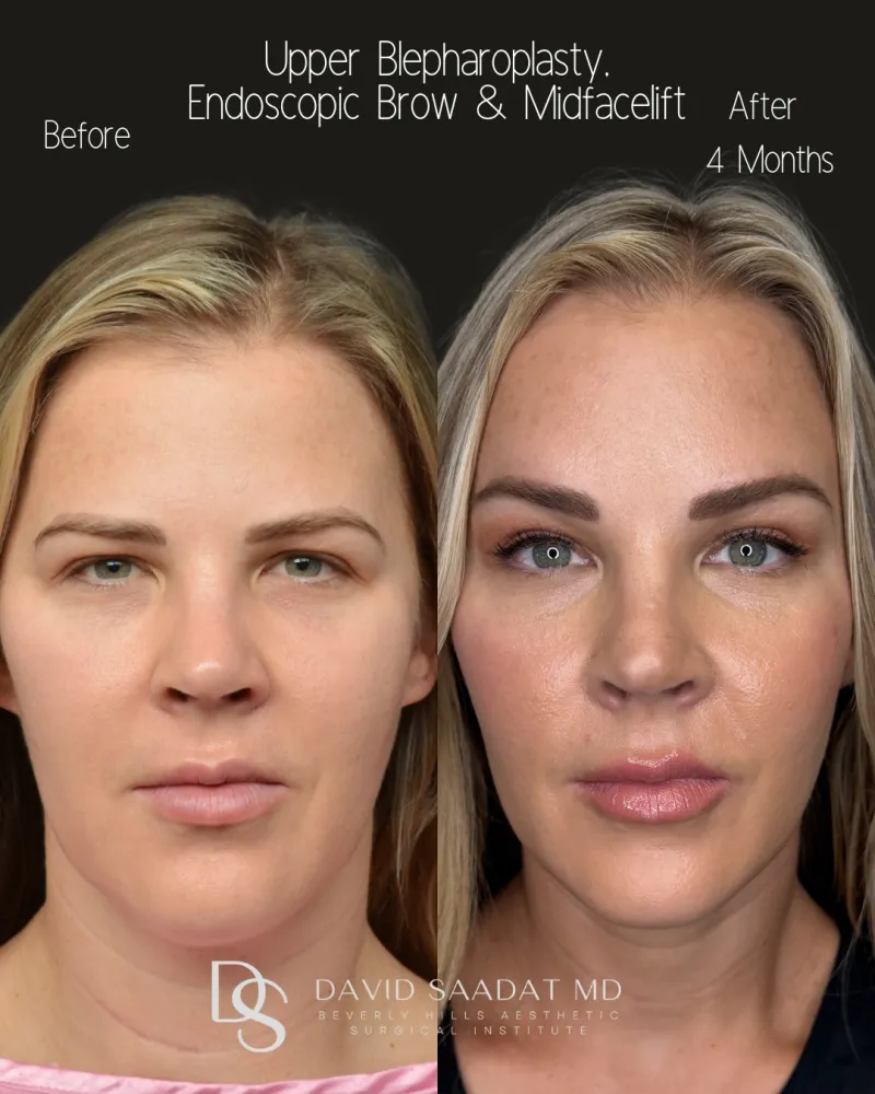 Before and after: Dr. David Saadat