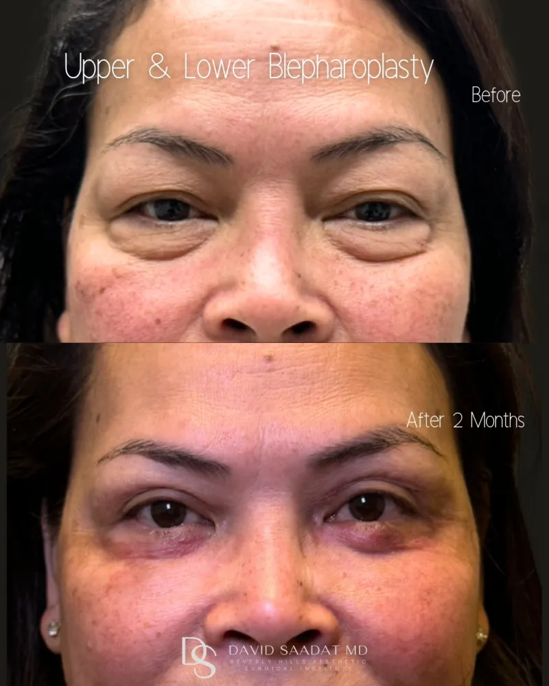 Before and after: Dr. David Saadat