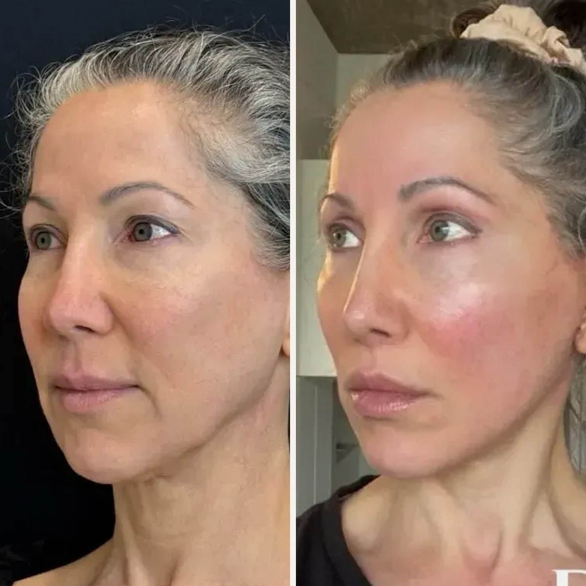 Before and after: Dr. Demetri Arnaoutakis