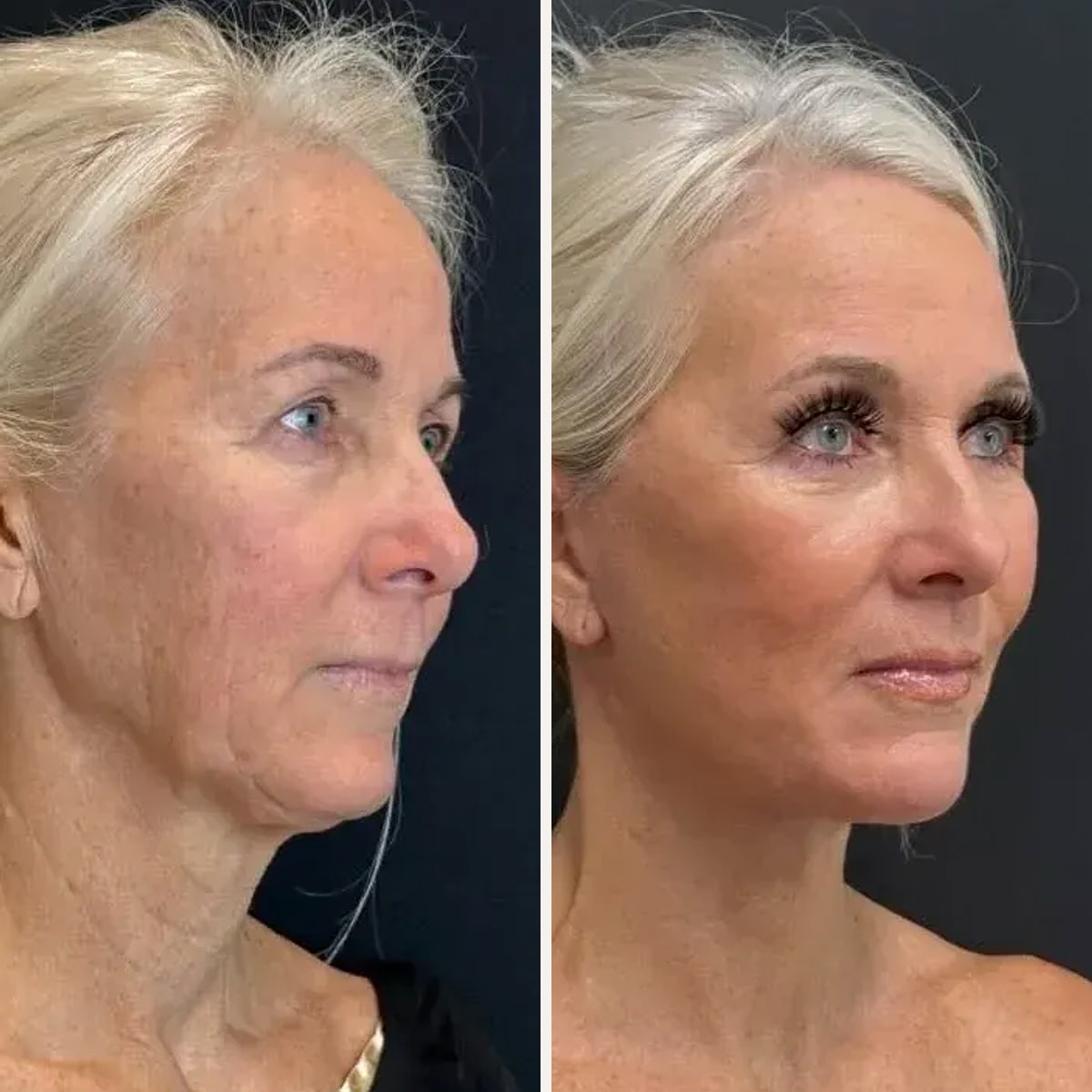 Before and after: Dr. Demetri Arnaoutakis