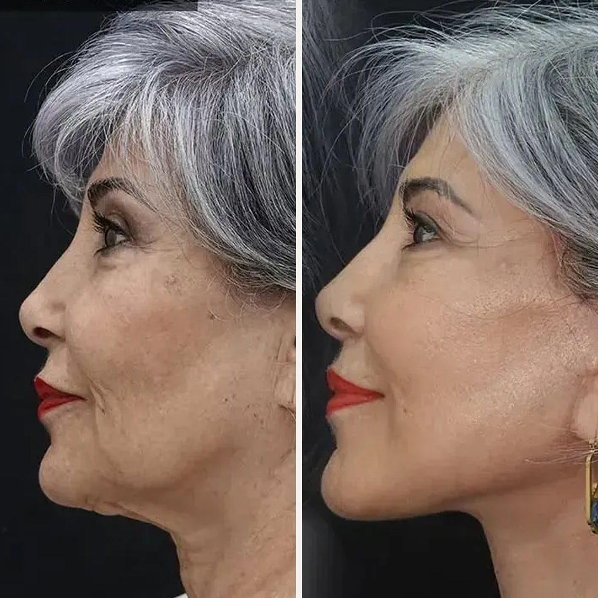 Before and after: Dr. Demetris Stavrou