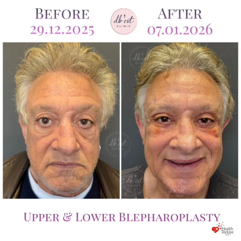 Before and after: Dr. Derya Bingöl