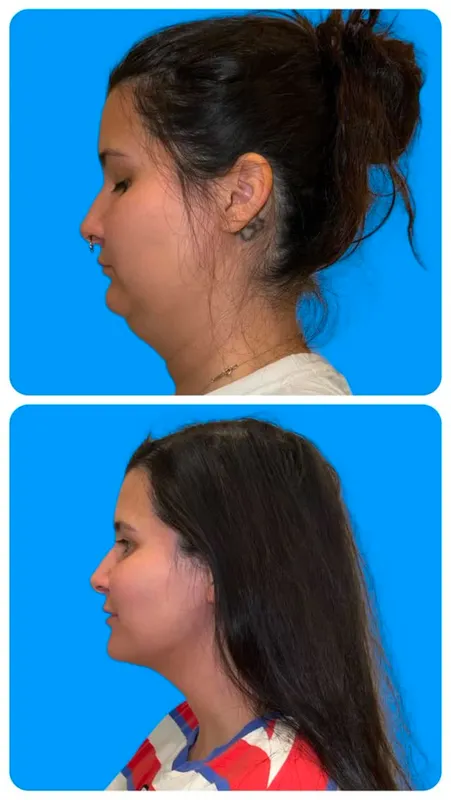 Before and after — Dr. Dev Wali