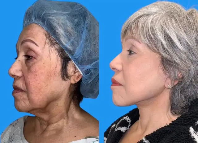 Before and after — Dr. Dev Wali