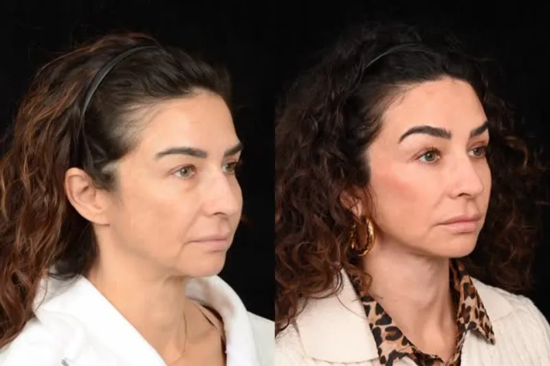 Before and after: Dr. Denton Watumull