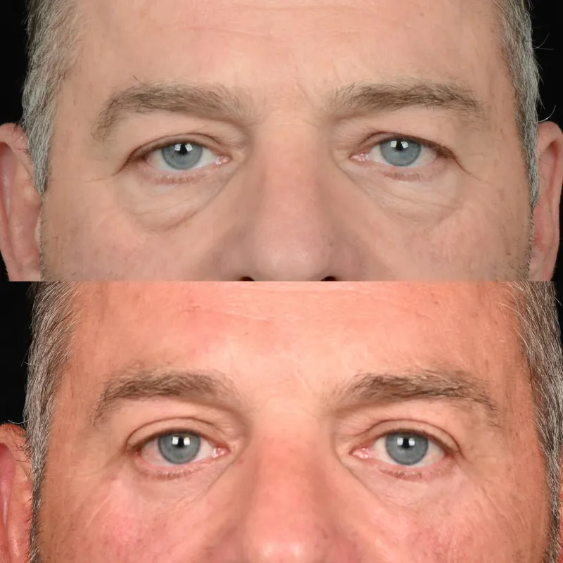 Before and after: Dr. Denton Watumull