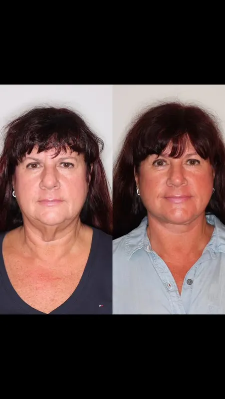 Before and after — Dr. Diana Flis