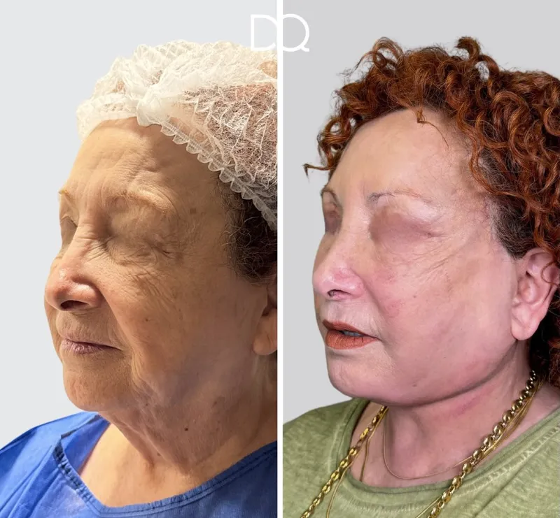 Before and after — Dr. Diego Quispe
