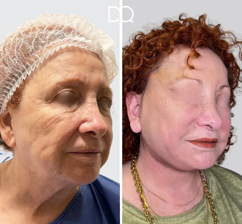 Before and after — Dr. Diego Quispe