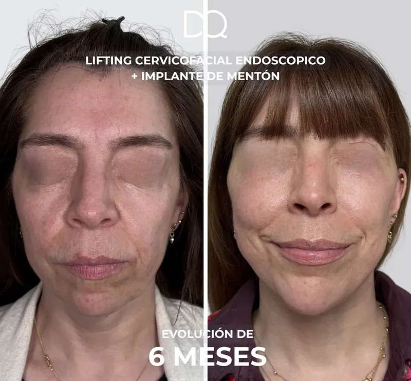Before and after: Dr. Diego Quispe