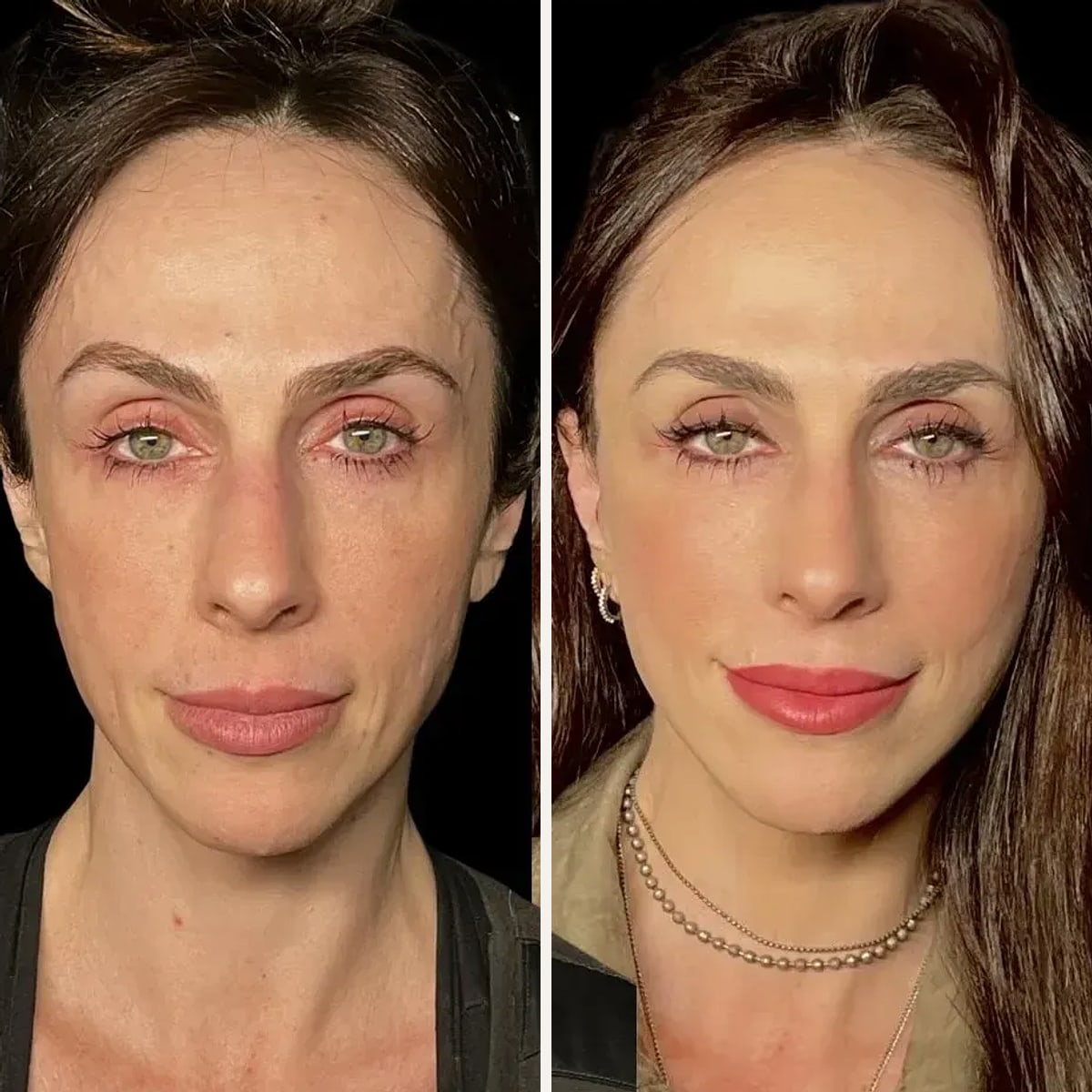 Before and after: Dr. Diego Ricardo