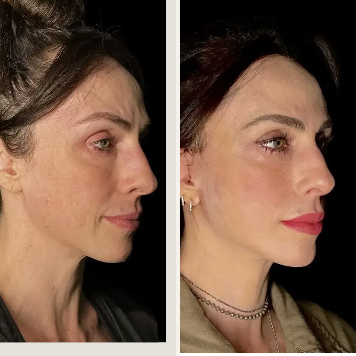 Before and after: Dr. Diego Ricardo