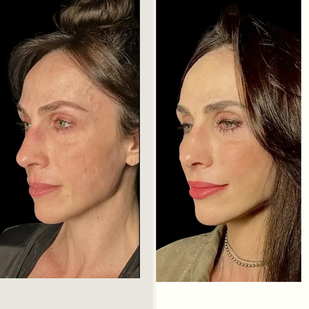 Before and after: Dr. Diego Ricardo