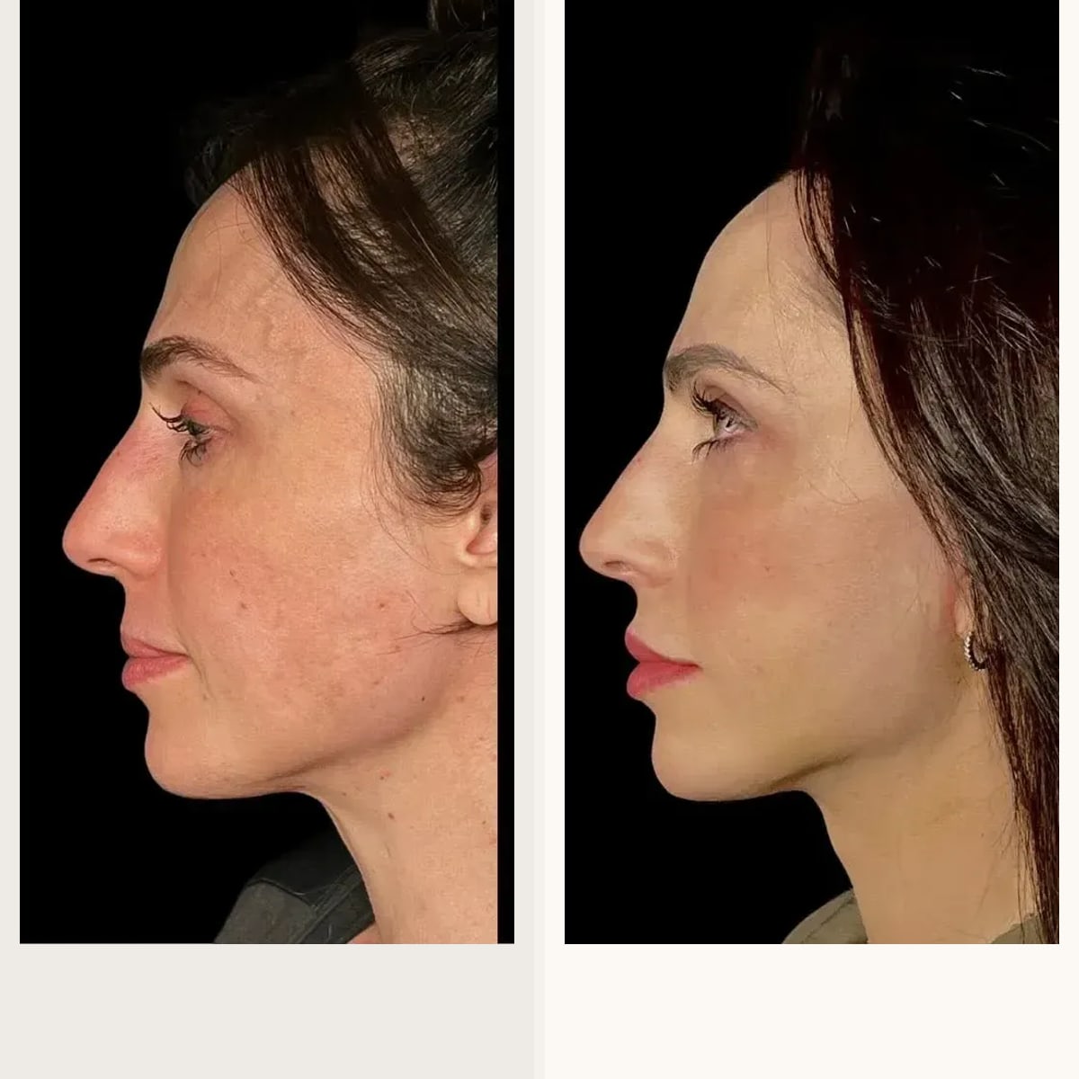 Before and after: Dr. Diego Ricardo