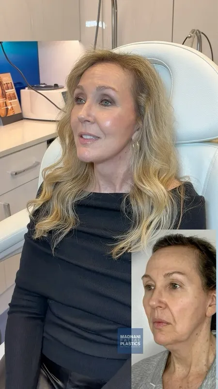 Before and after — Dr. Dilip Madnani