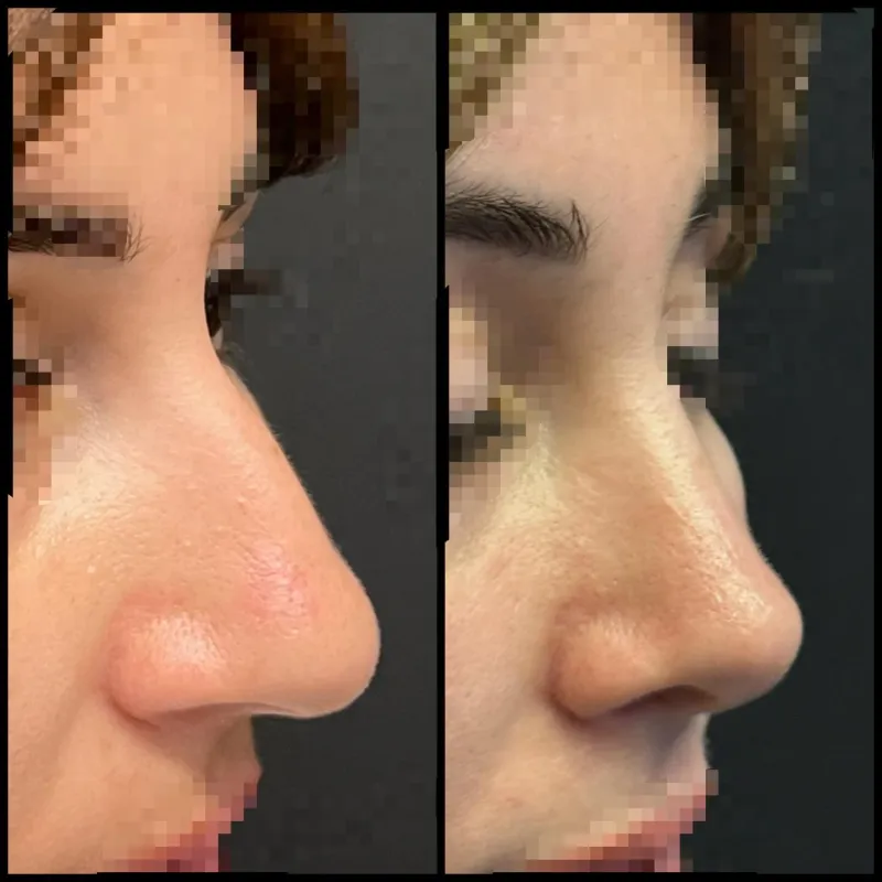 Before and after — Dr. Dilqem Meherremov