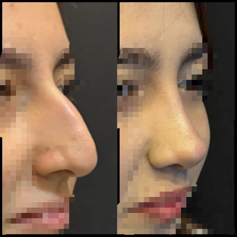 Before and after — Dr. Dilqem Meherremov