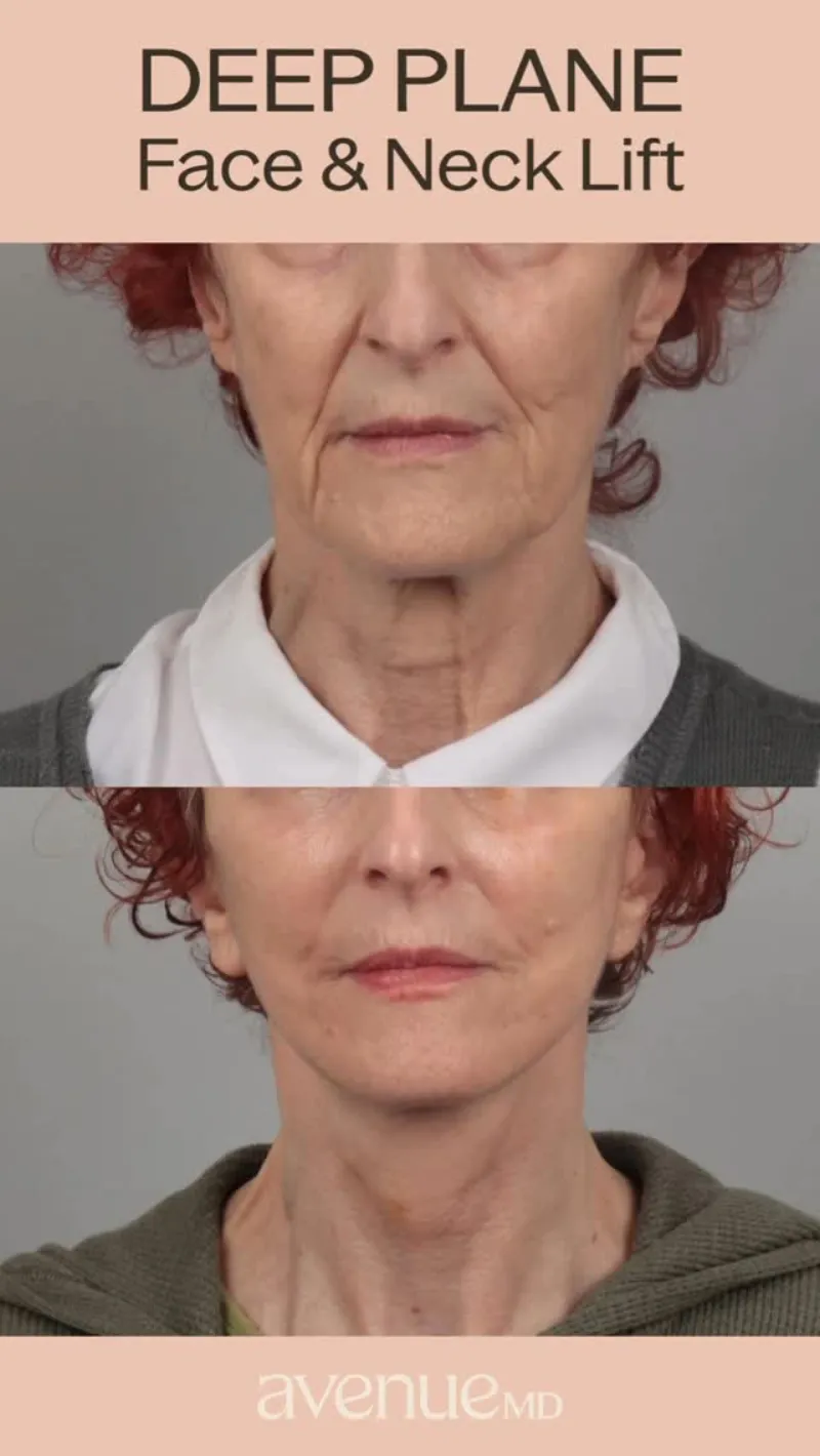 Before and after: Dr. Dimitrios Motakis