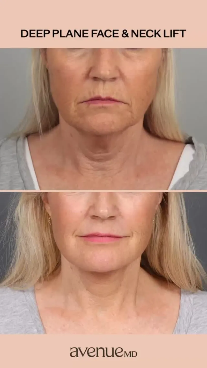 Before and after: Dr. Dimitrios Motakis