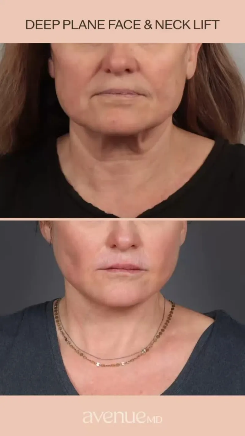 Before and after: Dr. Dimitrios Motakis