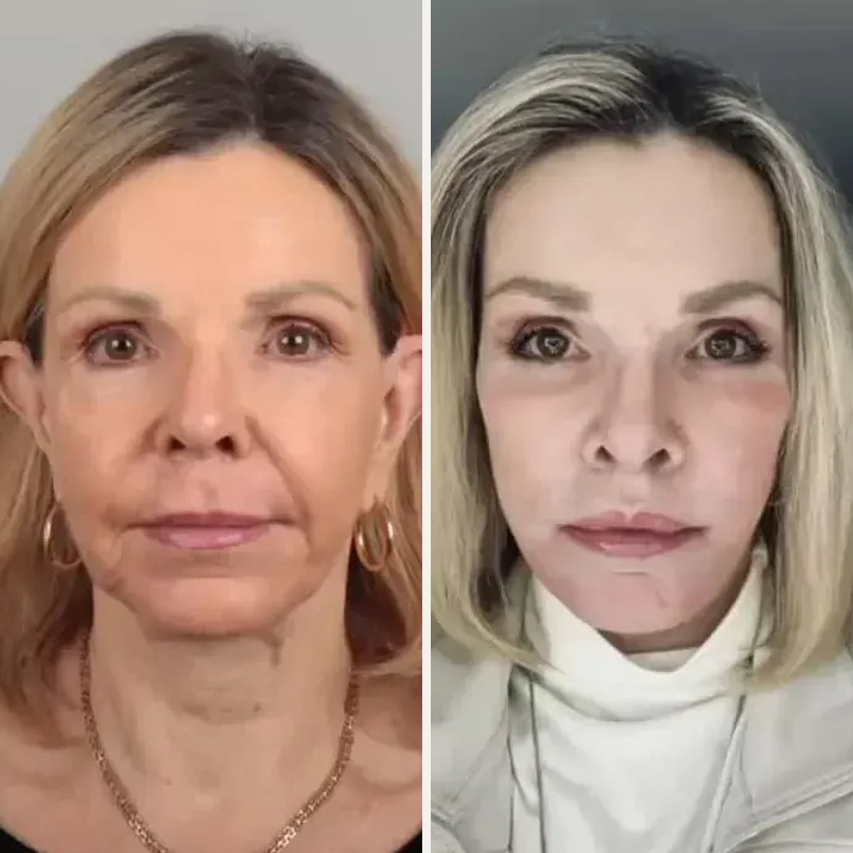 Before and after: Dr. Dimitrios Motakis
