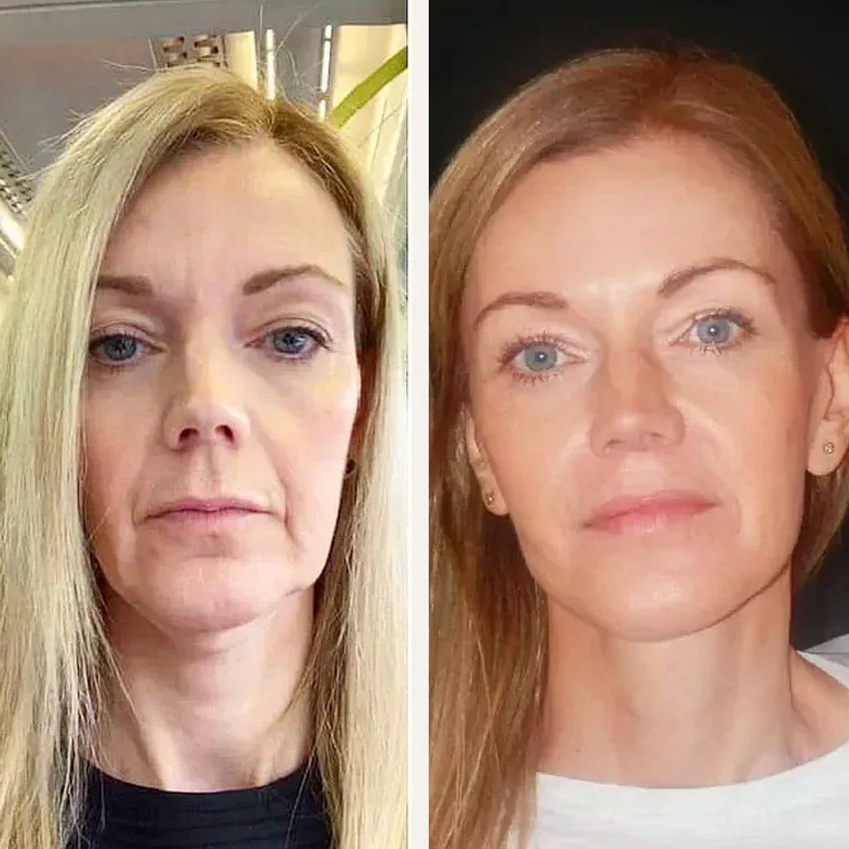 Before and after: Dr. Dirk Kremer