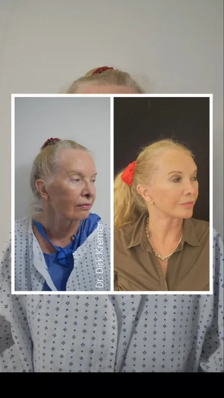 Before and after — Dr. Dirk Kremer