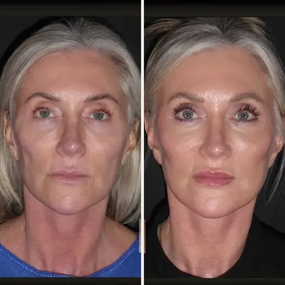 Before and after: Dr. Dominic Bray