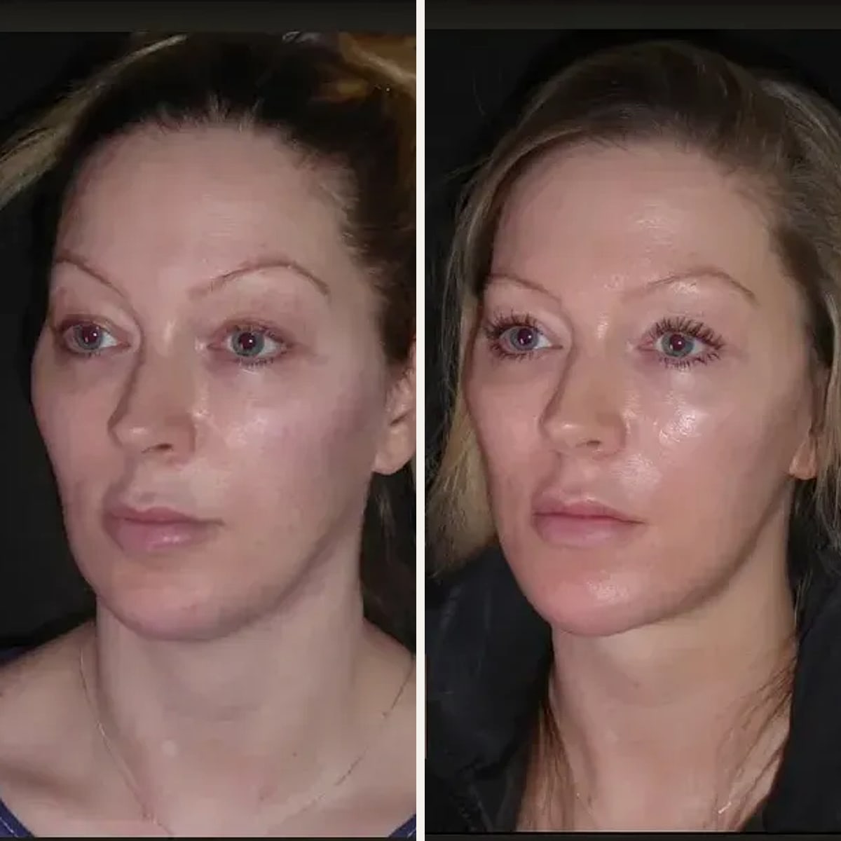 Before and after: Dr. Dominic Bray