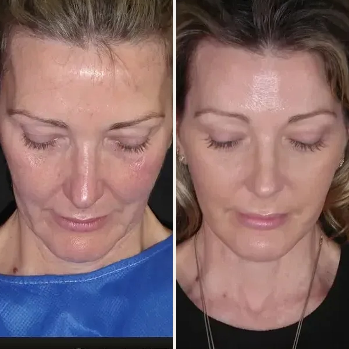 Before and after: Dr. Dominic Bray