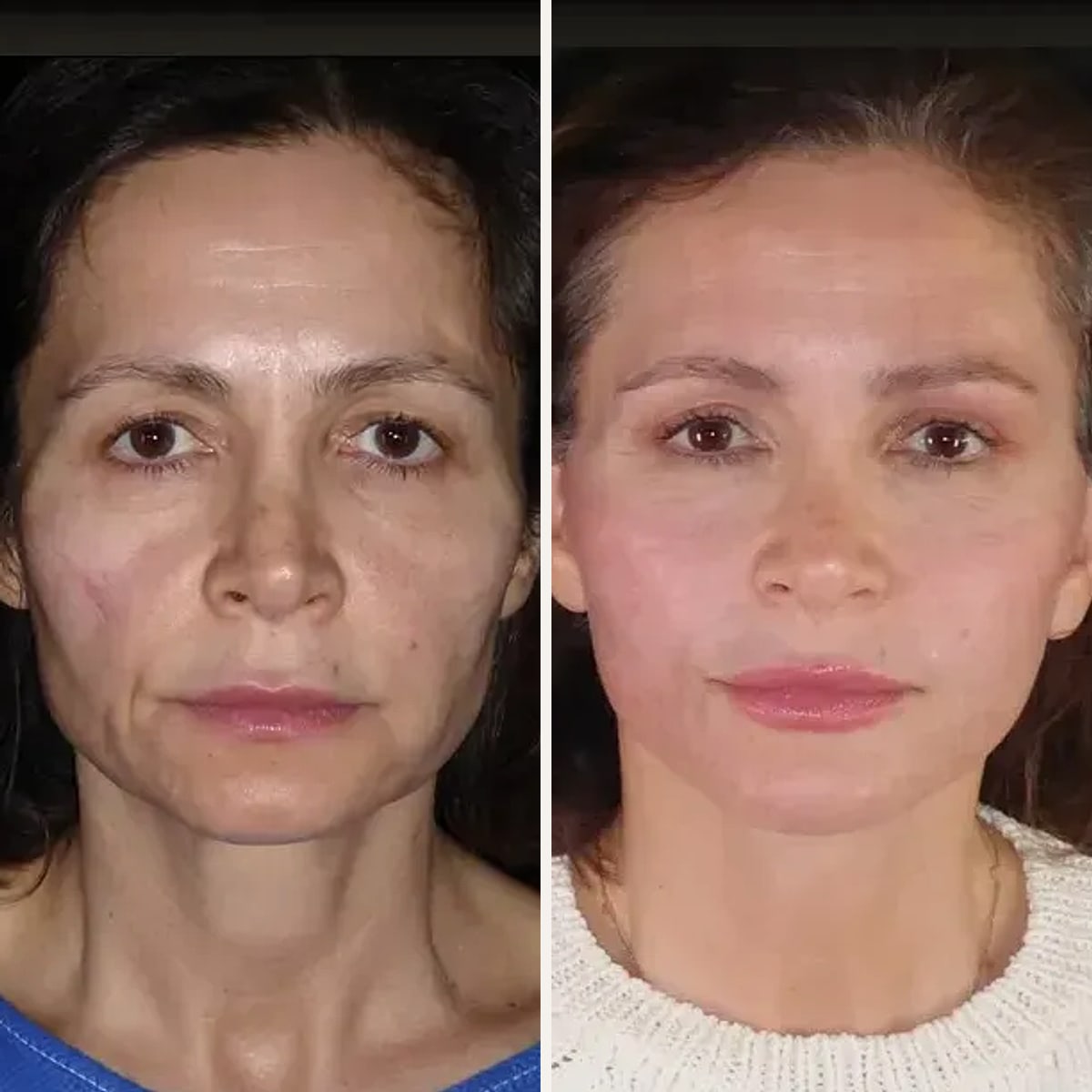 Before and after: Dr. Dominic Bray