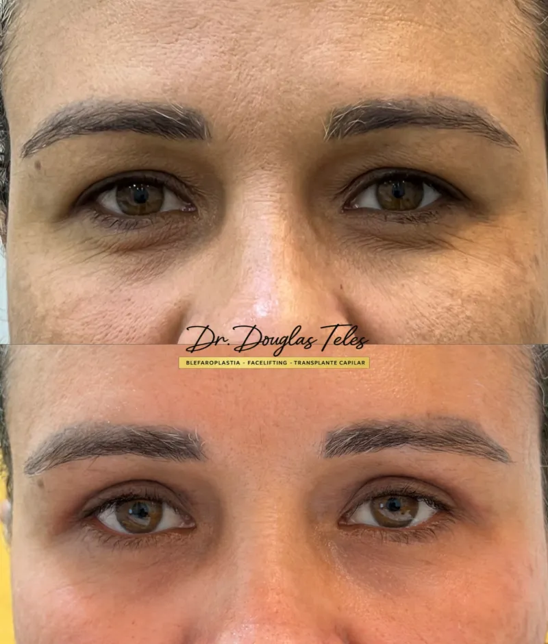 Before and after: Dr. Douglas Teles