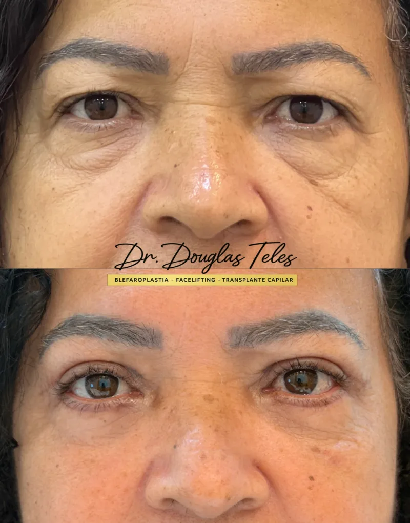 Before and after: Dr. Douglas Teles