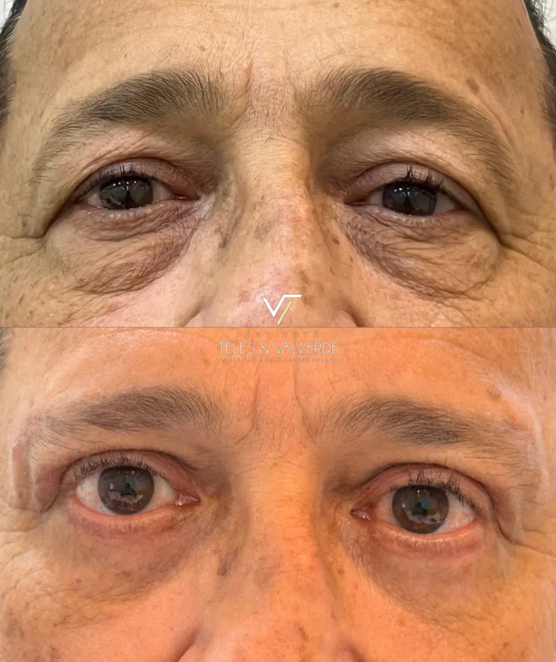 Before and after: Dr. Douglas Teles