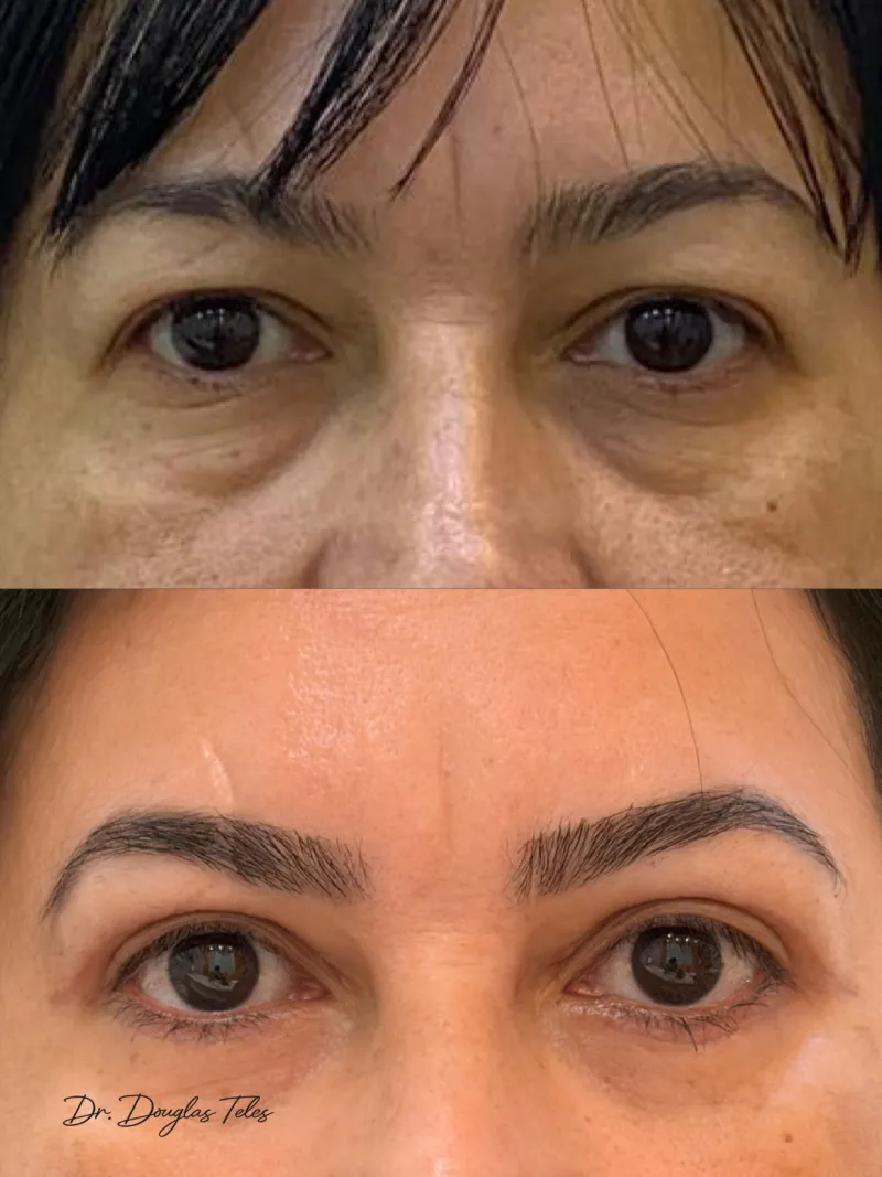 Before and after: Dr. Douglas Teles