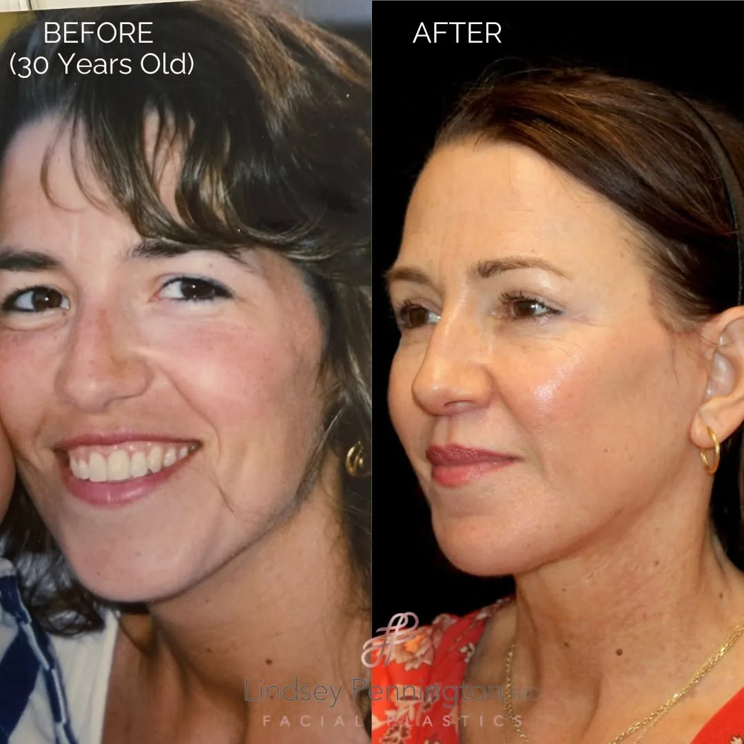 Before and after — Dr. Earl Pennington