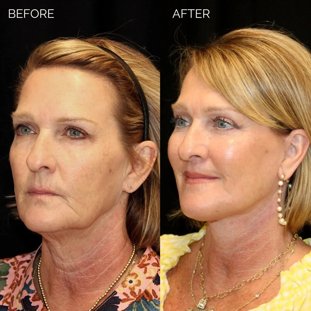 Before and after — Dr. Earl Pennington