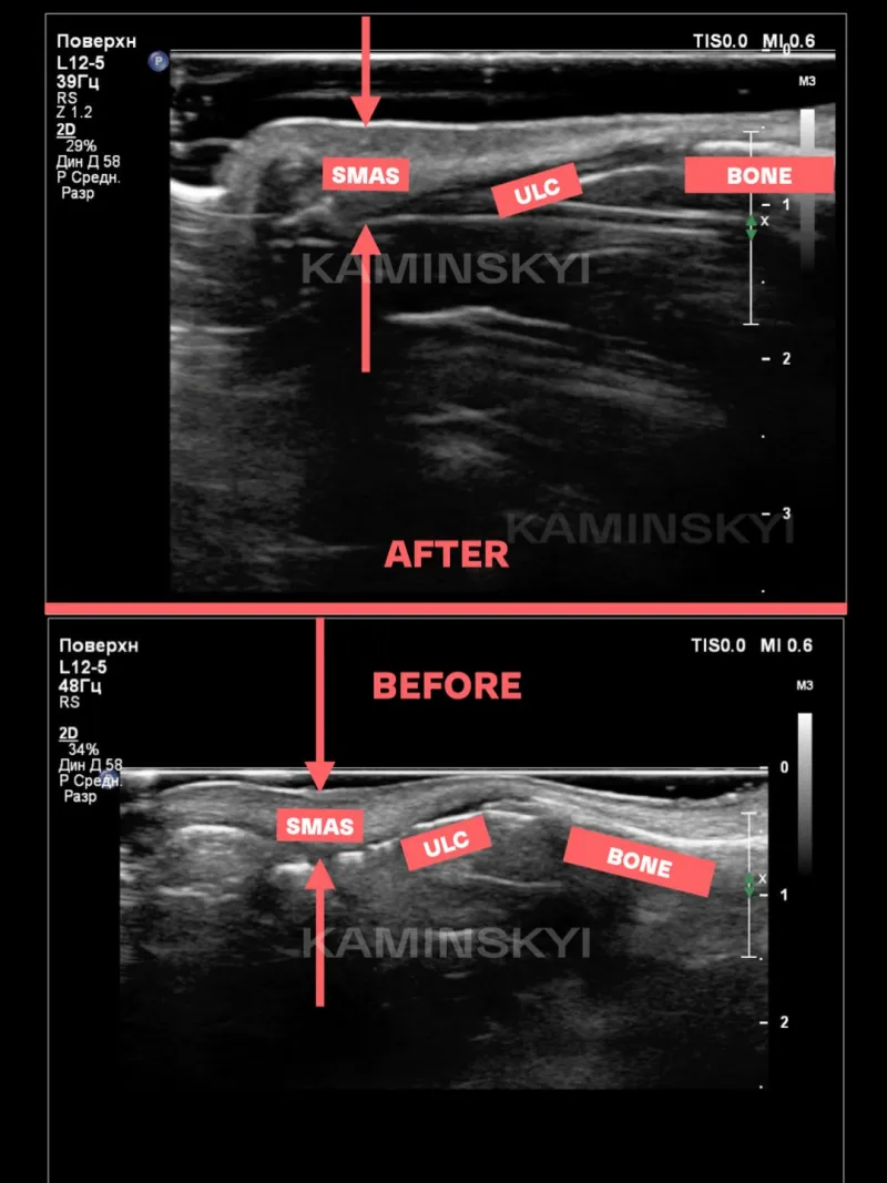 Before and after — Dr. Edgar Santos
