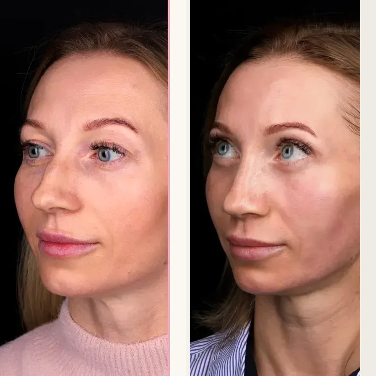 Before and after: Dr. Edgar Santos