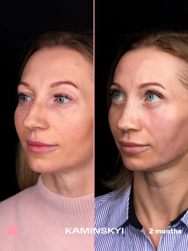 Before and after — Dr. Edgar Santos