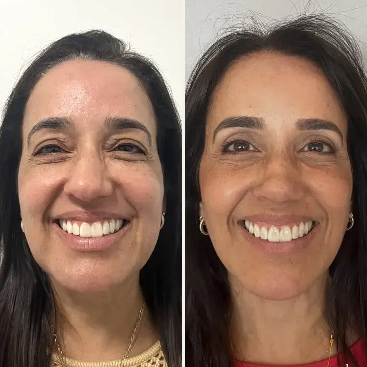 Before and after: Dr. Eduardo Kanashiro