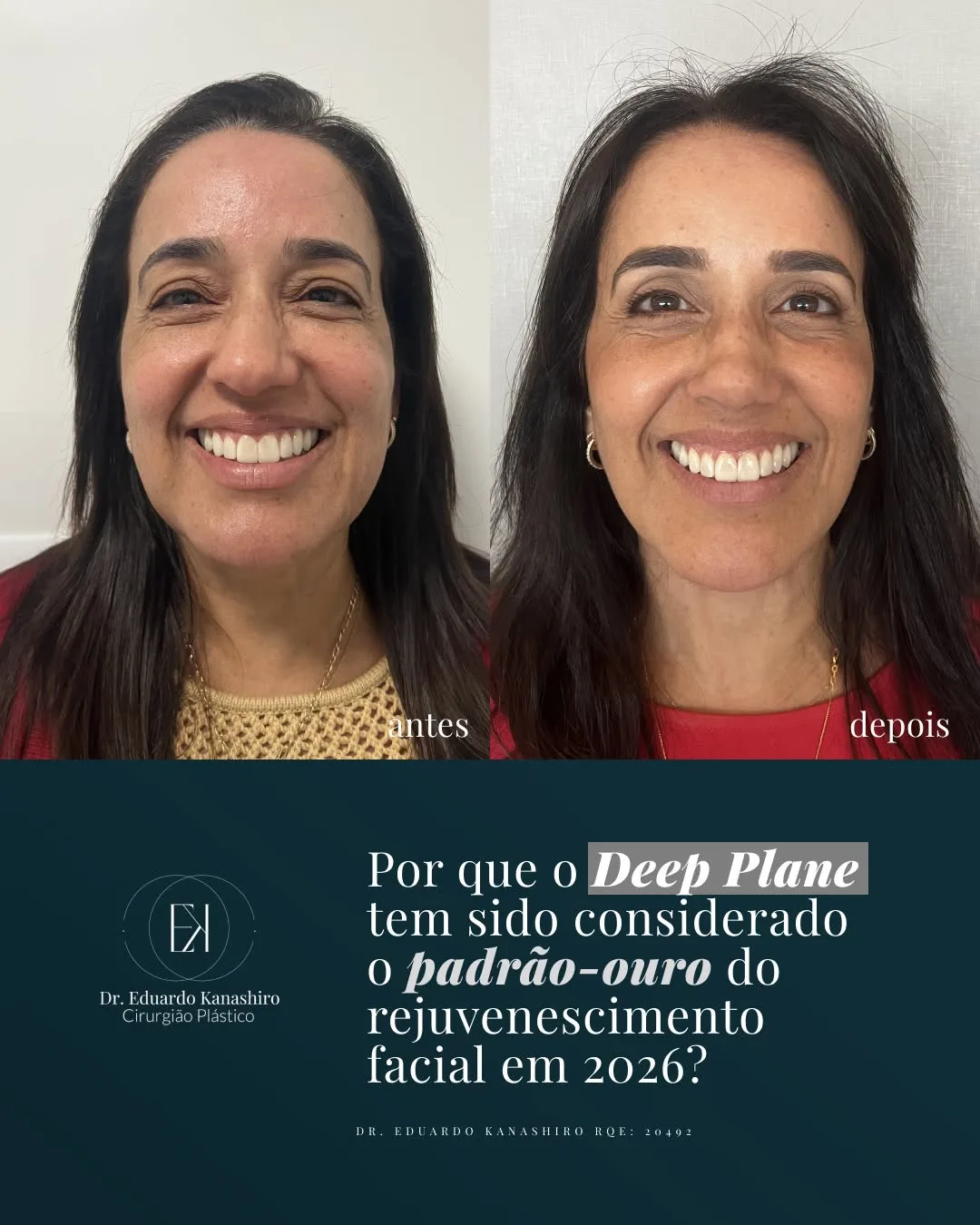 Before and after — Dr. Eduardo Kanashiro