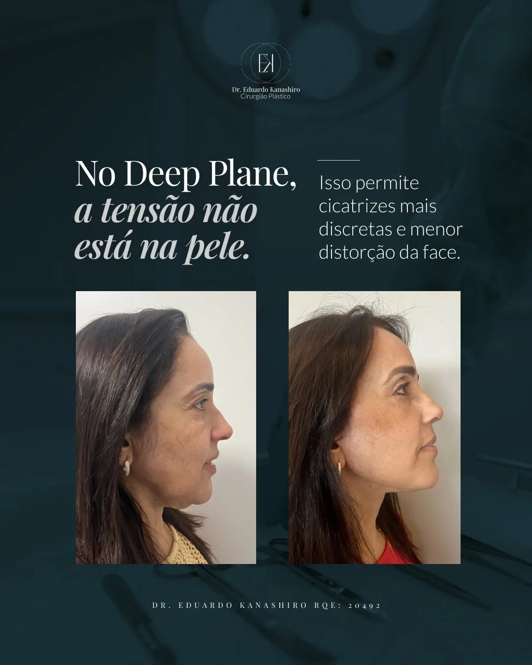 Before and after — Dr. Eduardo Kanashiro