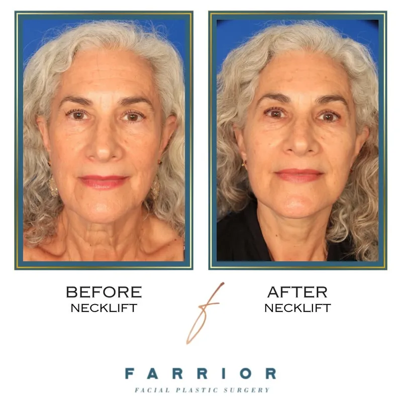 Before and after — Dr. Edward Farrior